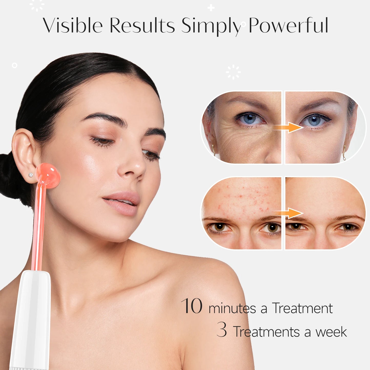 High Frequency Facial Machine Electrotherapy Wand